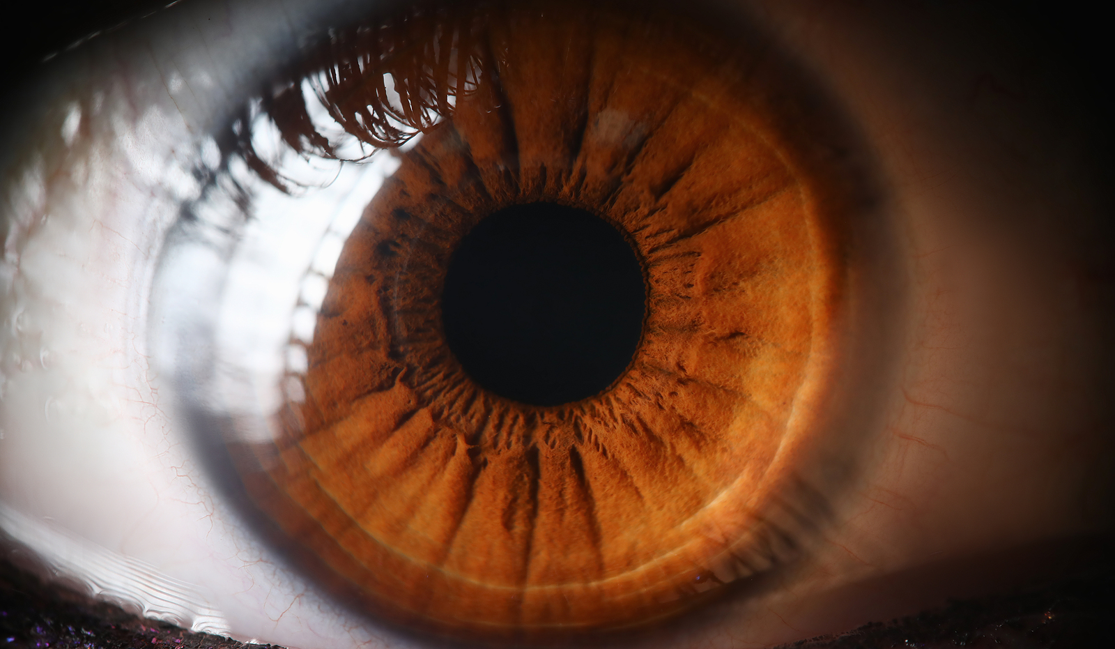 Retina Eye Conditions