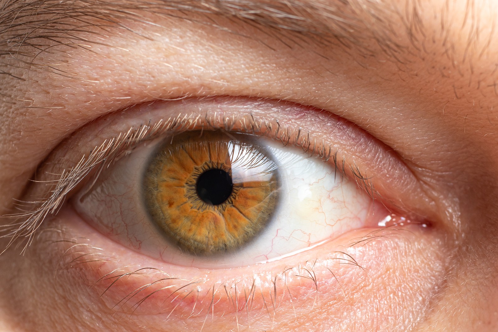 treating corneal eye conditions
