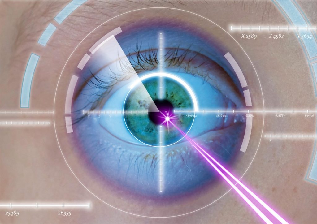 vision correction laser surgery